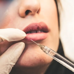 chirurgie plastica img